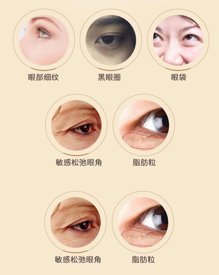 眼周肌肤问题
