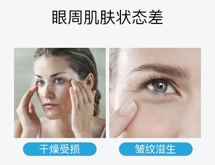 眼周肌肤状态