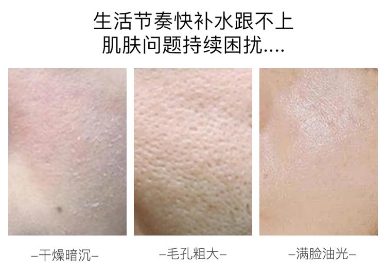 肌肤问题持续困扰，干燥暗沉、毛孔粗大、满脸油光
